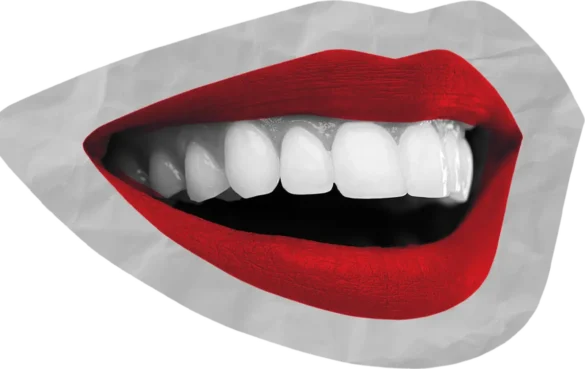 Bright white teeth with bold red lipstick against a grey and black background.